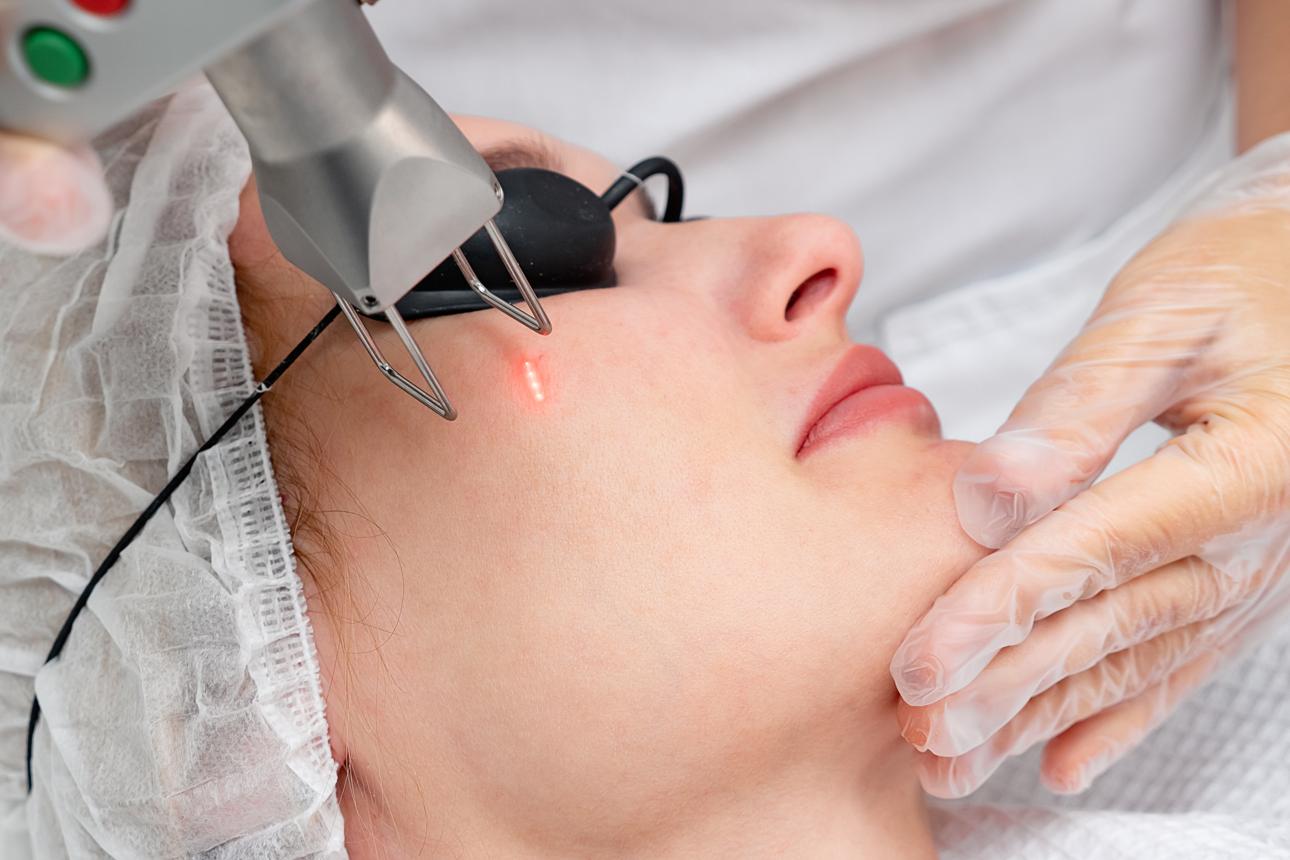 Skin Treatment